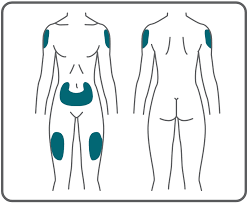 ozempic injection sites